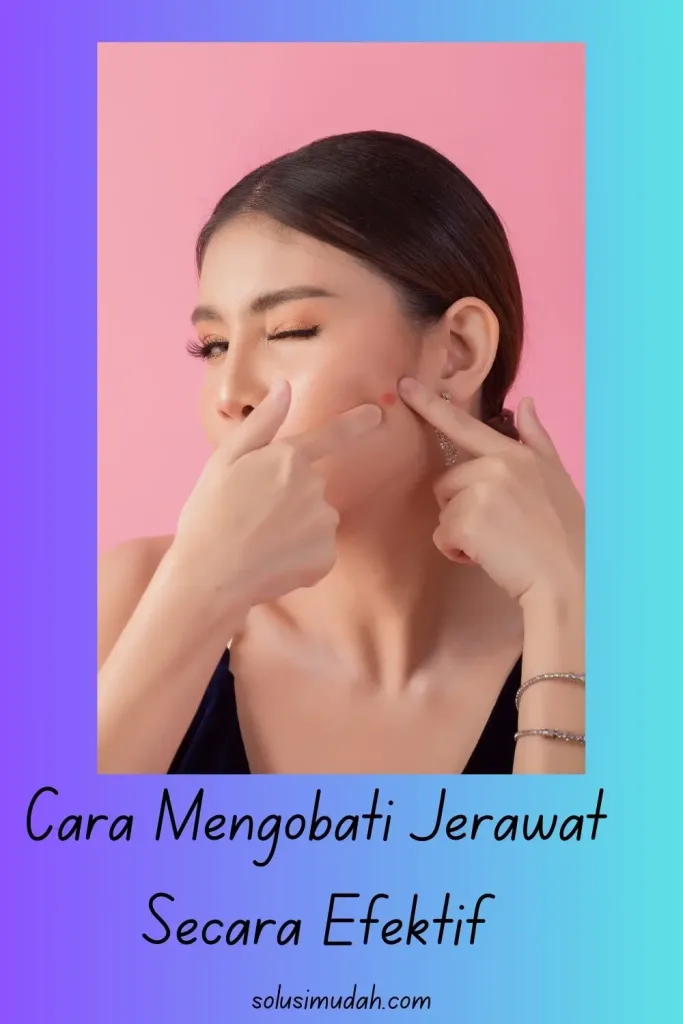 Cara-Mengobati-Jerawat-Secara-Efektif-683x1024 Cara Mengobati Jerawat Secara Efektif