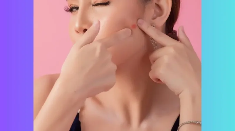 Cara Mengobati Jerawat Secara Efektif