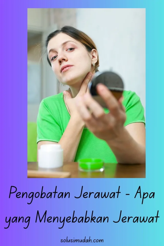 Pengobatan-Jerawat-Apa-yang-Menyebabkan-Jerawat-683x1024 Pengobatan Jerawat - Apa yang Menyebabkan Jerawat