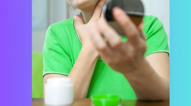 Pengobatan Jerawat - Apa yang Menyebabkan Jerawat